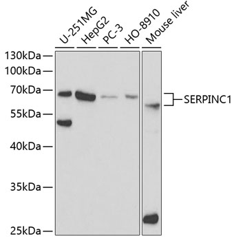 Anti-SERPINC1 Antibody (CAB1574)