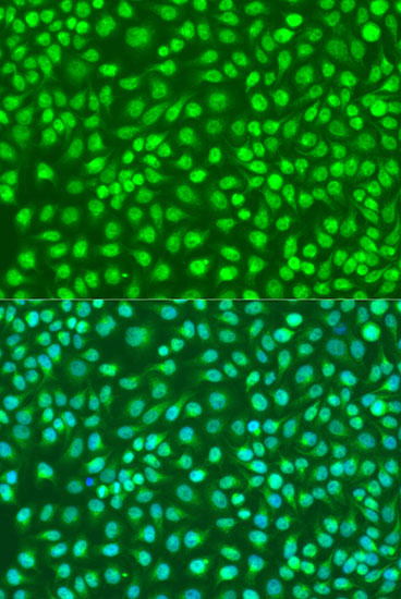 Anti-IKKBeta Antibody (CAB0714)