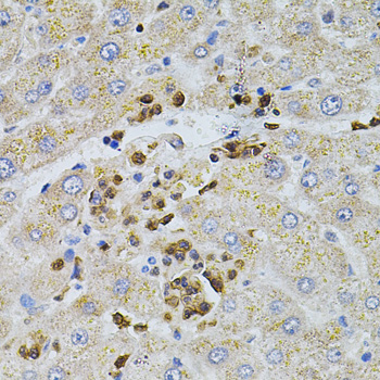 Anti-BEST1 Antibody (CAB3022)