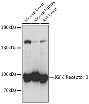 Anti-IGF1R Antibody (CAB16884)