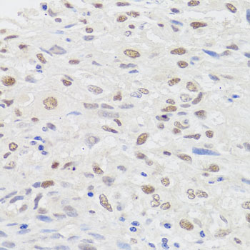 Anti-HMGN1 Antibody (CAB6155)