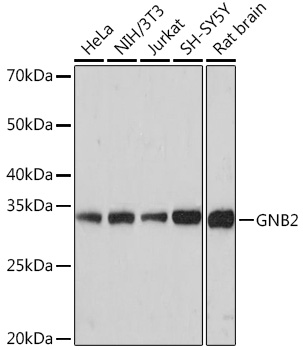 Anti-GNB2 Antibody (CAB9643)