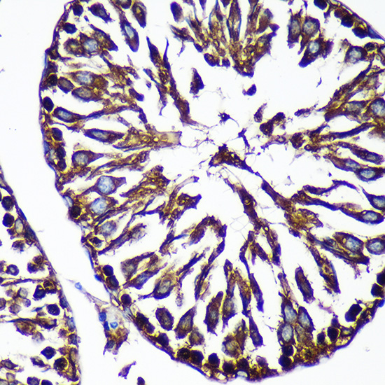 Anti-CTNNA3 Antibody (CAB16519)