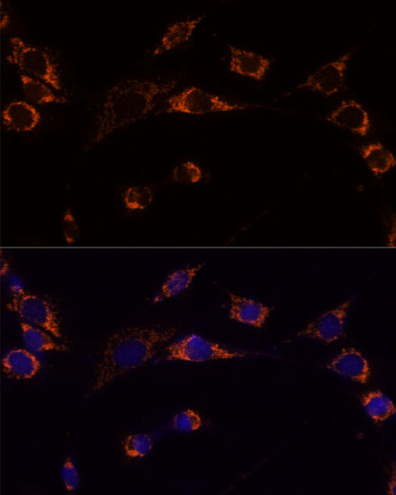 Anti-PRDX3 Antibody (CAB13074)