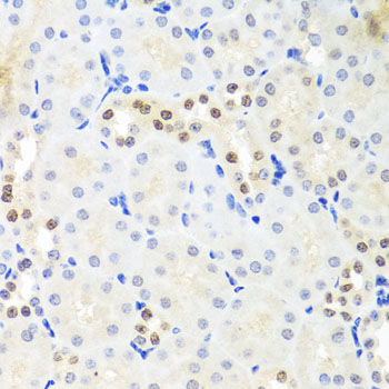 Anti-DDX39A Polyclonal Antibody (CAB7955)