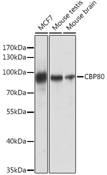 Anti-CBP80 Antibody (CAB13939)