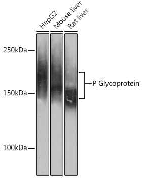 Anti-P Glycoprotein Antibody (CAB19093)