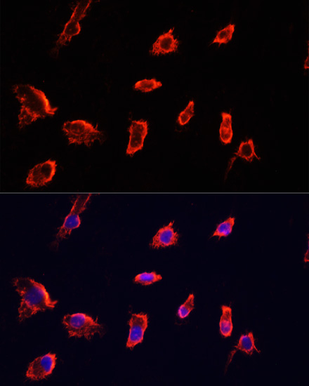 Anti-ARF1 Antibody (CAB7643)