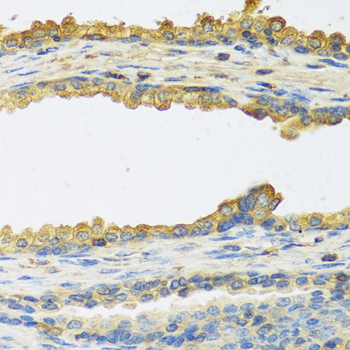 Anti-TSHB Antibody (CAB6780)