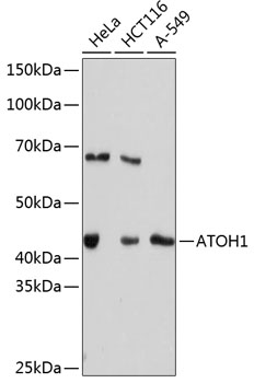 Anti-ATOH1 Antibody