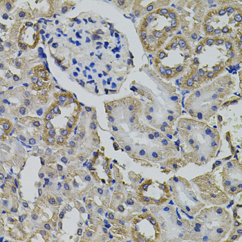 Anti-AARS Antibody (CAB7864)