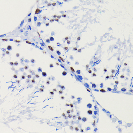 Anti-HDAC1 Antibody [KO Validated] (CAB19571)