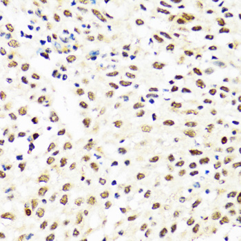 Anti-TIA1 Antibody (CAB6237)