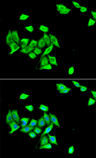 Anti-DNMT3A Antibody (CAB6503)