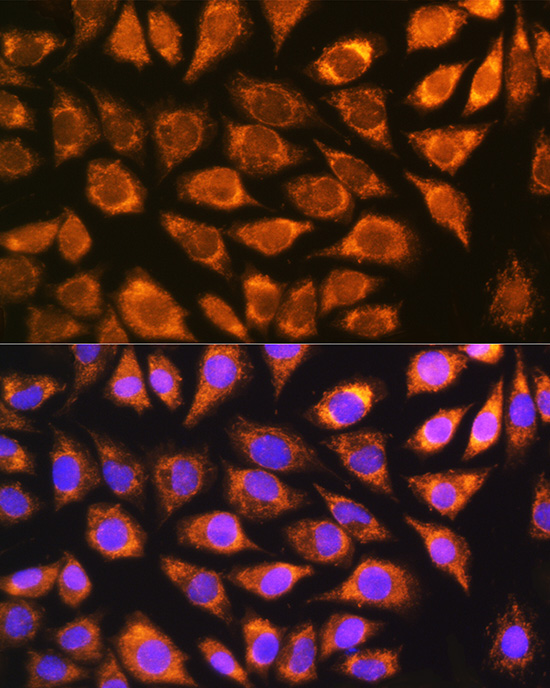 Anti-NDUFS5 Antibody (CAB1265)