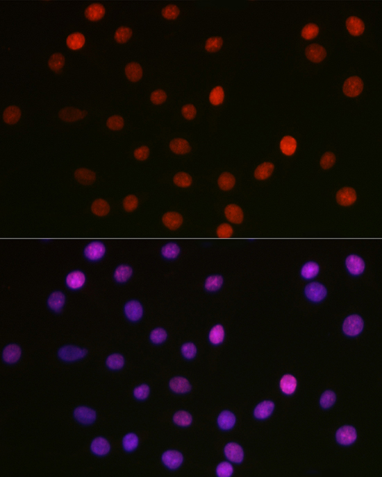 Anti-Acetyl-HMGB1-K29 Antibody [KO Validated] (CAB16002)