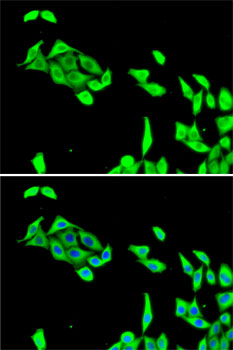 Anti-CDK5 Antibody (CAB5730)