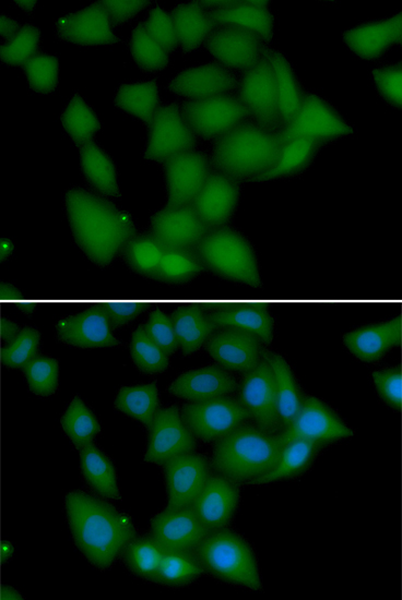 Anti-CAMK1 Antibody (CAB7018)