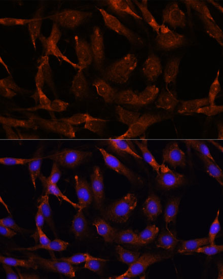 Anti-WNT10B Antibody (CAB16717)