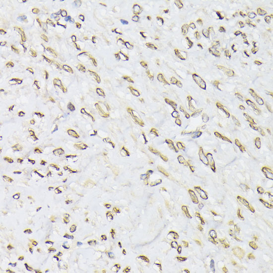 Anti-EMD Antibody (CAB1132)