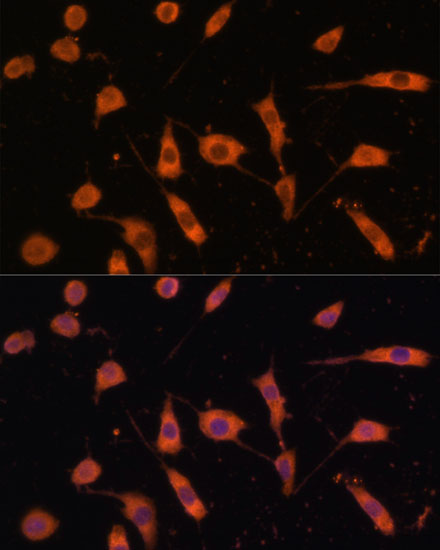 Anti-STING / TMEM173 Antibody (CAB3575)