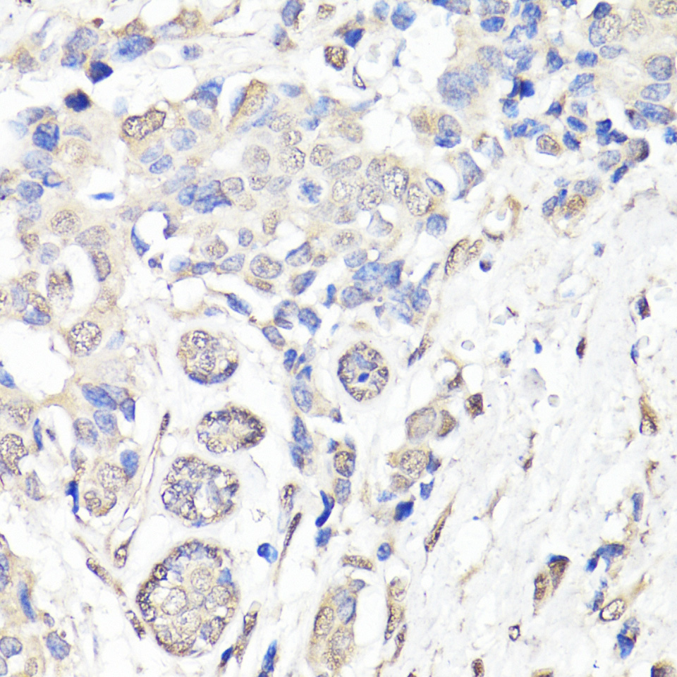 Anti-BAP1 Antibody (CAB6533)