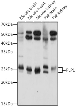 Anti-PLP1 Antibody (CAB20009)