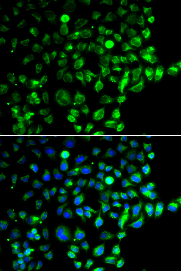 Anti-RAB31 Antibody (CAB3667)