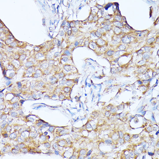 Anti-CTSF Antibody (CAB10469)