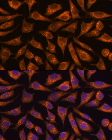 Anti-B3GNT4 Antibody (CAB15896)