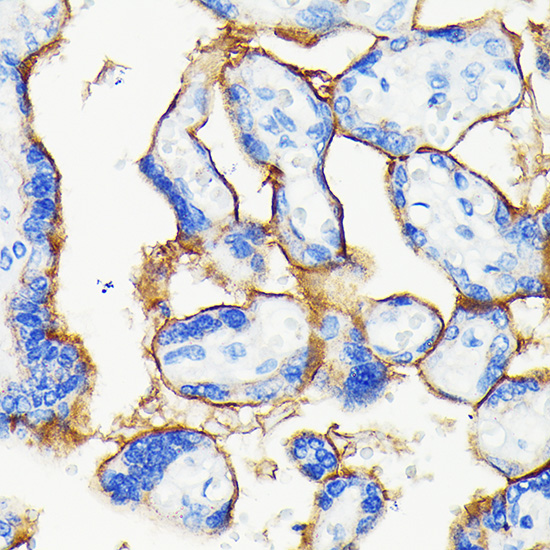 Anti-PD-L1 Antibody [KO Validated] (CAB19135)