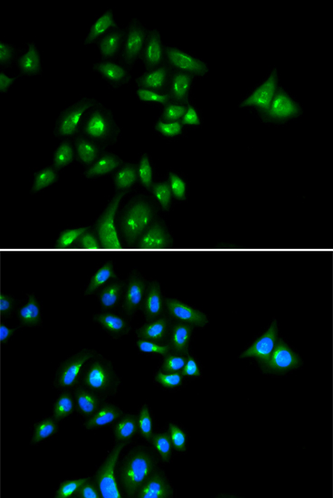 Anti-PHC3 Antibody (CAB14151)