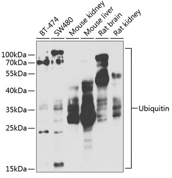 Anti-Ubiquitin Antibody (CAB2129)