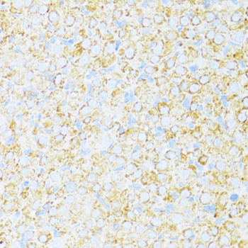 Anti-UQCR10 Antibody (CAB12587)