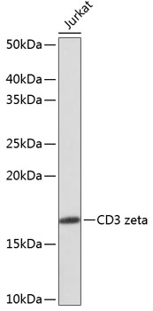 Anti-CD3 zeta Antibody