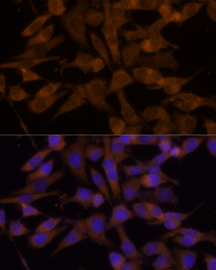 Anti-UGT2B7 Antibody (CAB1693)