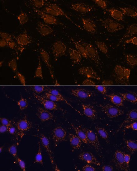 Anti-HSPA13 Antibody (CAB4132)