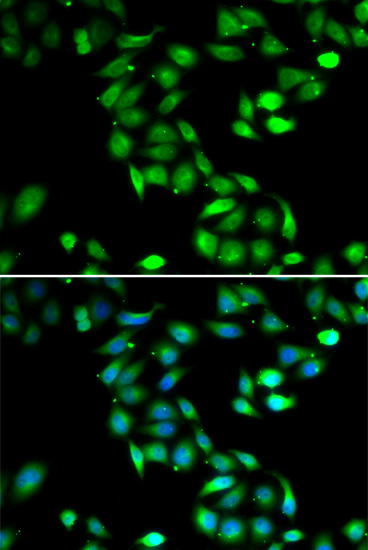 Anti-PDCD6 Antibody (CAB6685)