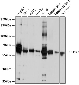 Anti-USP39 Polyclonal Antibody (CAB9582)