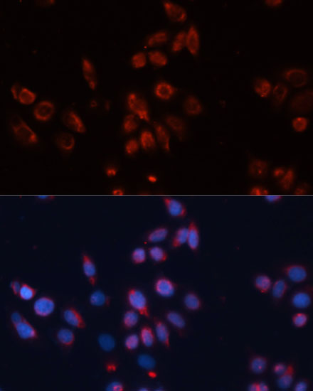 Anti-GPC4 Antibody (CAB12805)