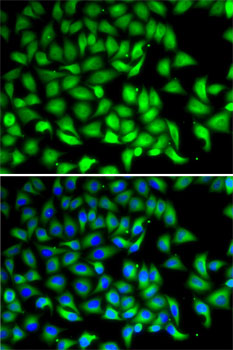 Anti-SUFU Antibody (CAB6757)