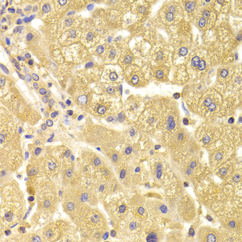 Anti-TRAF3IP2 Antibody (CAB6776)