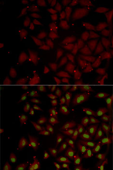 Anti-CCL25 Antibody (CAB2685)