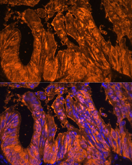 Anti-Galectin 4 Antibody (CAB17417)