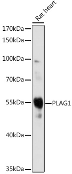 Anti-PLAG1 Antibody (CAB16952)