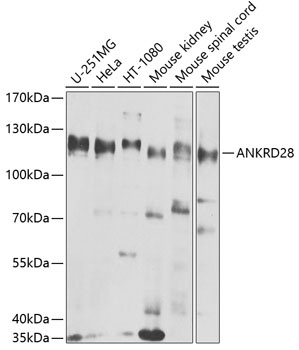 Anti-ANKRD28 Polyclonal Antibody (CAB8365)