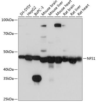 Anti-NFS1 Antibody (CAB6668)