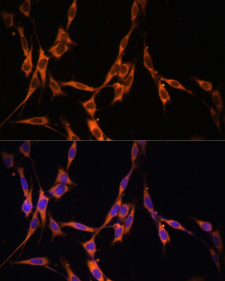 Anti-KRAS Antibody (CAB1190)