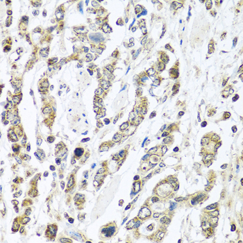 Anti-IFNL3 Antibody (CAB12908)