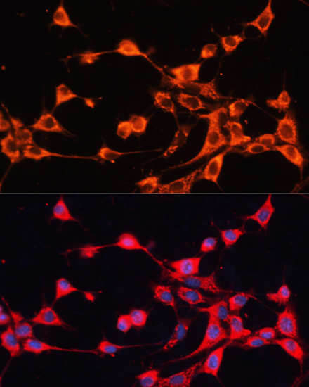 Anti-ABCB10 Antibody (CAB13787)